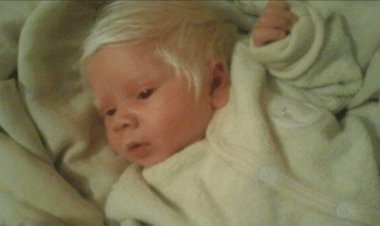 Bebê surpreende ao nascer com o cabelo todo branco no interior do RS