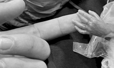 Nasce João Miguel, filho de Whindersson e Maria Lina, prematuro de 22 semanas