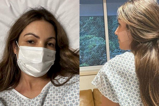 Patrícia Poeta desabafa sobre cirurgia de emergência: "Rosto desfigurado"