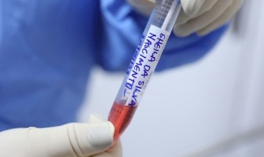 Sequenciamento genômico: Governo do Amazonas reforça rastreio de casos da variante Ômicron