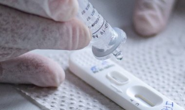 ANS inclui teste rápido de Covid-19 nas coberturas obrigatórias dos planos