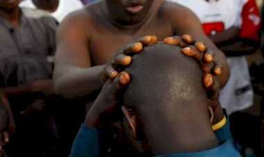 Homens carecas são decapitados em Moçambique porque crença diz haver ouro dentro das suas cabeças