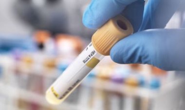 Casos de hepatite infantil de causa desconhecida chegam a 169 em 12 países, diz OMS