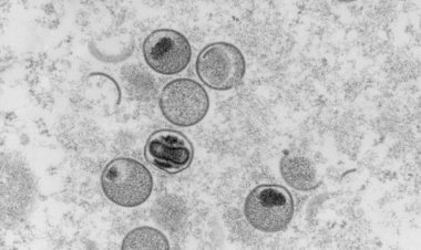 Ministério da Saúde confirma terceiro caso da varíola dos macacos