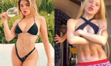 Gkay se irrita com críticas ao seu corpo após plásticas: "Deixa eu ser feia em paz"