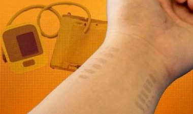 Dispositivo de “tatuagem eletrônica” monitora pressão arterial durante 5 horas