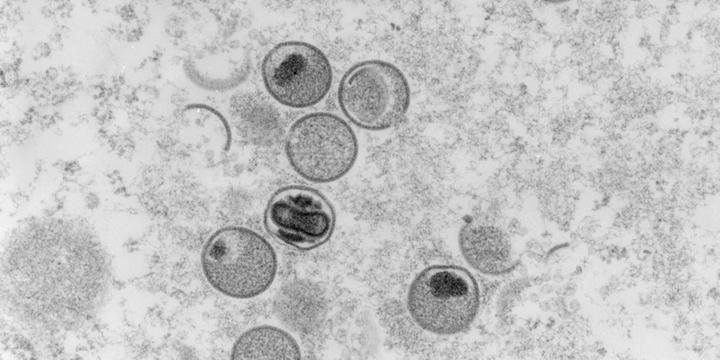 Ministério da Saúde confirma terceiro caso da varíola dos macacos