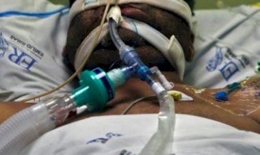 Crescem em todo país os casos de síndrome respiratória aguda grave