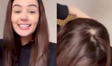 Eslovênia Marques diz que tem alopecia: 'Nem sabia que isso existia'