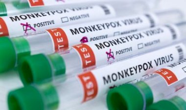 Primeira morte por varíola dos macacos é confirmada em São Paulo