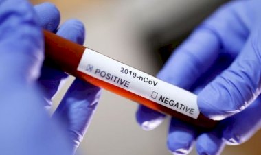 Brasil tem média de 128 mortes por Covid e total passa de 696 mil