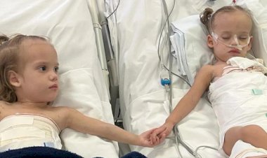 Após encontro com a irmã, siamesa separada é extubada em Goiânia