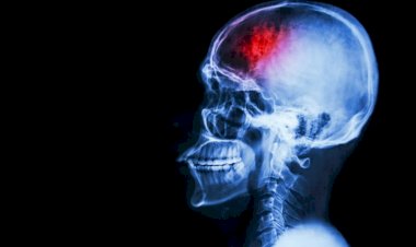 Médicos afirmam que Covid causou derrame em adolescente de 14 anos