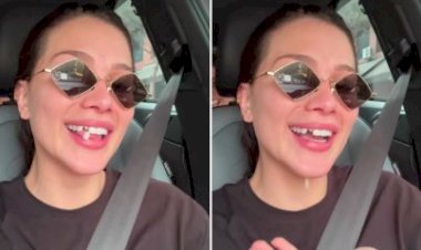 Flavia Pavanelli fica “banguela” após lente de contato dental cair