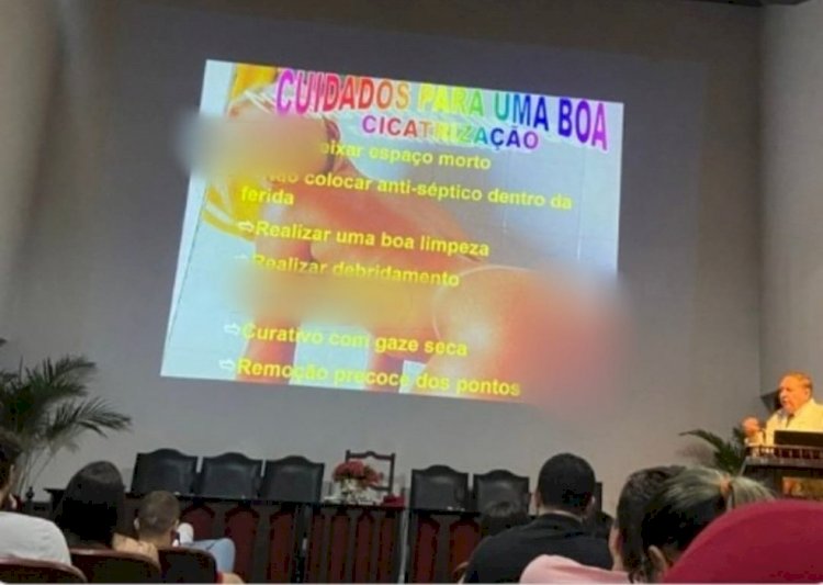 Médico usa foto de mulher nua em slide durante curso de emergência clínico-cirúrgica em Maceió