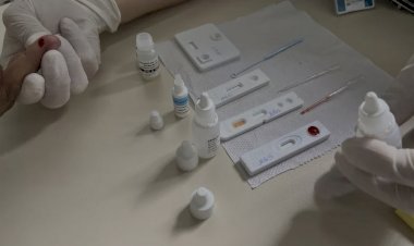 HIV: jovens de 15 a 29 anos representam 51% dos novos casos de infecção no DF