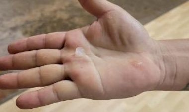 Em meio a calor, cidades no interior do AM registram chuva de granizo