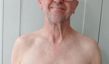 ‘Eu não tinha ideia de que homens poderiam ter câncer de mama’, diz homem após encontrar caroço no mamilo