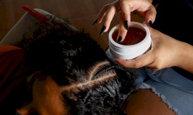 Mais de 100 pessoas são levadas a hospital com queimaduras nos olhos após uso de pomada de cabelo