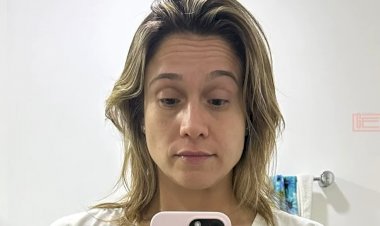 Paralisia de Bell: entenda doença que deixou Fernanda Gentil sem mover parte do rosto e saiba como diferenciá-la de um AVC