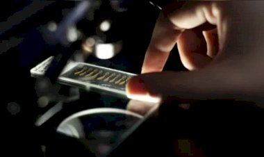 Bactéria encontrada na Amazônia pode curar câncer e Herpes