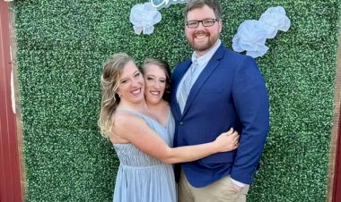 Irmã siamesa casada com enfermeiro posta mensagem a haters