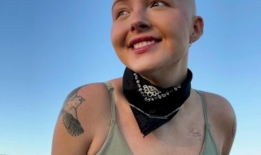 Maddy Baloy, TikToker que compartilhou sua luta contra o câncer terminal, morre aos 26 anos