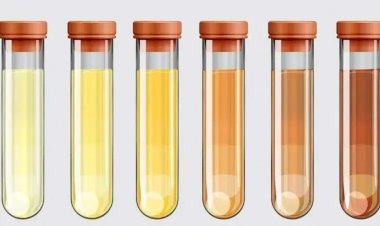 O que a cor do xixi revela sobre sua saúde ou alimentação