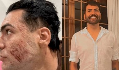 Peeling de fenol: morte de paciente após procedimento em clínica foi causada por 'edema pulmonar agudo' ao inalar produto, diz laudo do IML