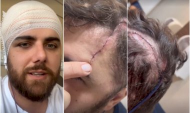 Cantor Zé Neto sofre acidente e é internado no interior de São Paulo