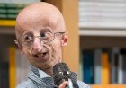 Morre Sammy Basso, o “Benjamin Button da vida real”, aos 28 anos