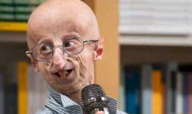 Morre Sammy Basso, o “Benjamin Button da vida real”, aos 28 anos