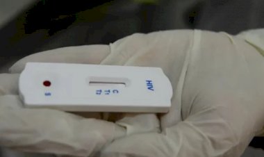 Seis pacientes transplantados no RJ receberam órgãos infectados com HIV, diz Secretaria de Saúde