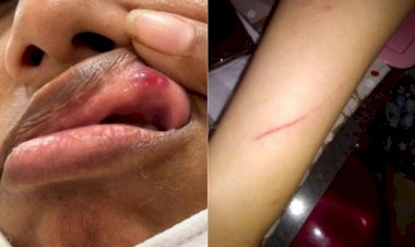 Mãe e filha atacadas por não cederem assento a criança em avião vão processar agressores, diz advogada