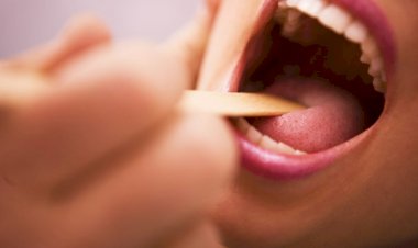 Pedra nas amígdalas pode causar mau hálito; veja outros problemas