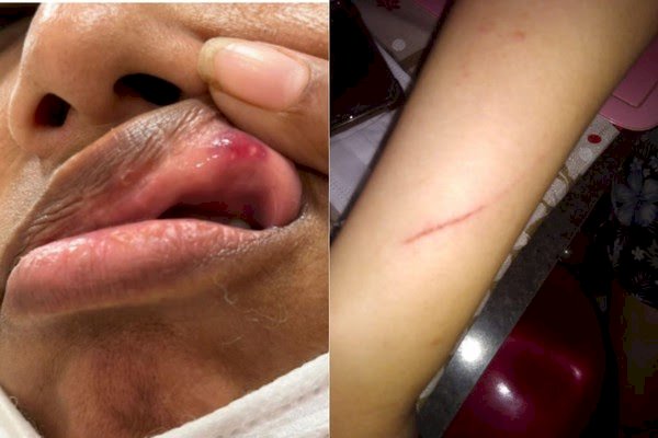Mãe e filha atacadas por não cederem assento a criança em avião vão processar agressores, diz advogada