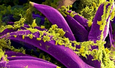 Morador do norte do Arizona, nos EUA, morre de peste pneumônica