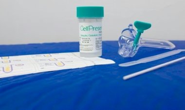 Papanicolau: entenda o que muda com o substituto do exame no SUS