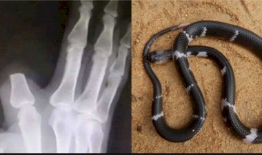 Idoso é picado por cobra, corta o próprio dedo para conter o veneno, mas se assusta com descoberta infeliz