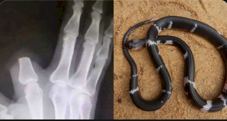 Idoso é picado por cobra, corta o próprio dedo para conter o veneno, mas se assusta com descoberta infeliz