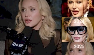 Madonna chama atenção com rosto mais natural após fase marcada por aparência 'overfilled'