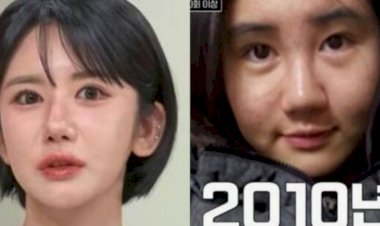 Transformação impressionante: sul-coreana gasta mais de R$ 1 milhão em cirurgias plásticas