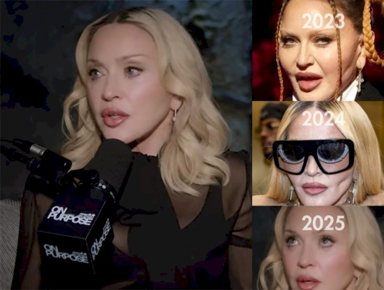 Madonna chama atenção com rosto mais natural após fase marcada por aparência 'overfilled'