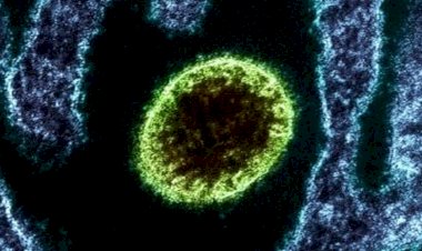 Quais os riscos do vírus Nipah chegar ao Brasil?