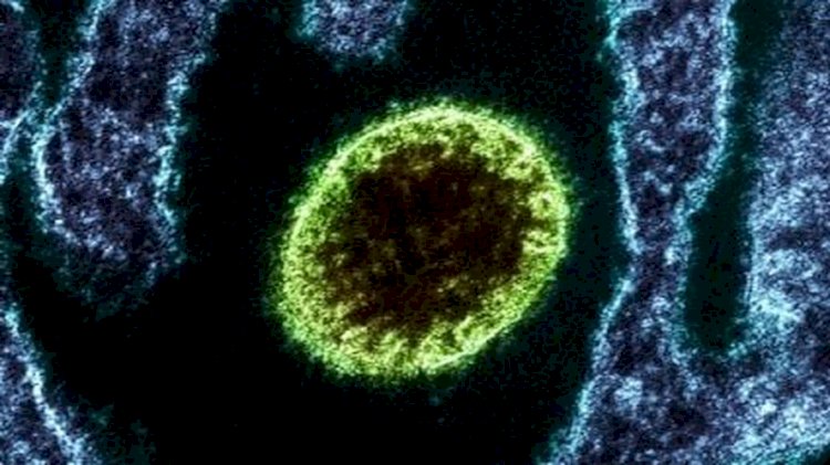 Quais os riscos do vírus Nipah chegar ao Brasil?