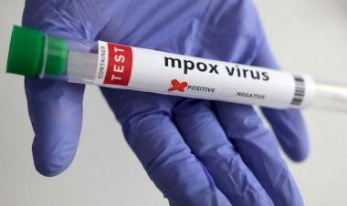 Casos de mpox dobram no Brasil e chegam a 129; SP tem (66%) das confirmações