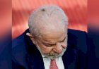 Lula tira lesão de pele no couro cabeludo e tem alta para casa