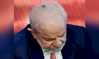 Lula tira lesão de pele no couro cabeludo e tem alta para casa