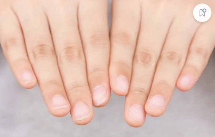 Especialista de Harvard revela a surpreendente conexão entre o crescimento das unhas e a longevidade