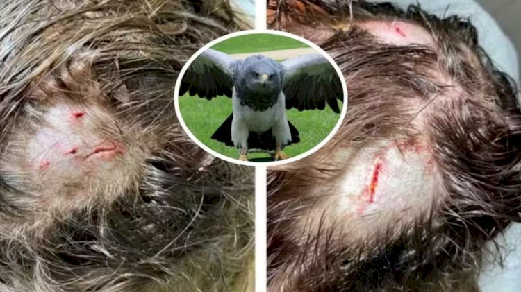 Primeiro ataque de harpia a humano já documentado no mundo ocorre na Amazônia e acende alerta sobre perseguição à espécie; entenda